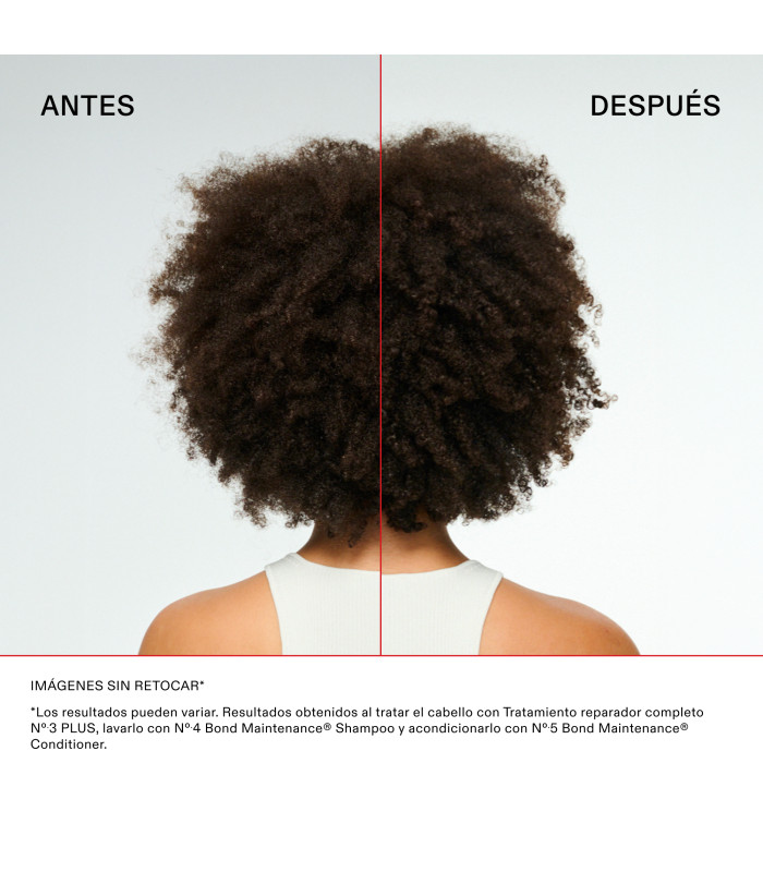 Kit Sistema de Mantenimiento de Enlaces